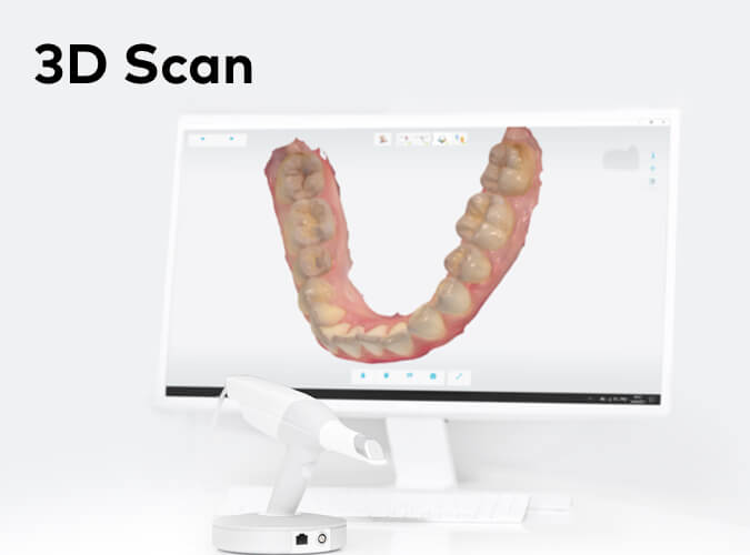 3D Scan – Wir scannen Deine Zähne. Schluss mit unangenehmer Abdruckmasse.