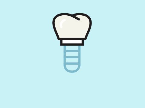 Oralchirurgie - Zahn verloren? Wir ersetzen ihn!