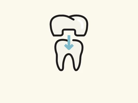 Zahnersatz - Wir füllen jede Lücke - opensmile Neukölln