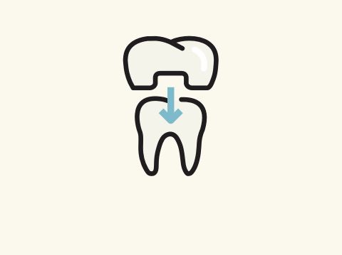 Zahnersatz - Wir füllen jede Lücke - opensmile Neukölln